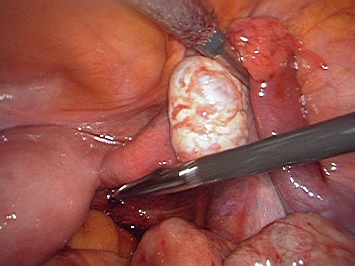 rigt-tube-blue-dye-passed rigt-tube-blue-dye-passed