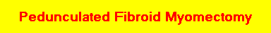 Pedunculated Fibroid Myomectomy