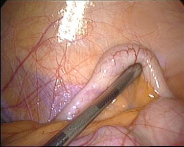 appendix appendix