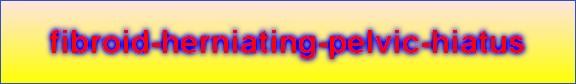fibroid-herniating-pelvic-hiatus