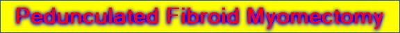 Pedunculated Fibroid Myomectomy