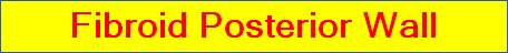 Fibroid Posterior Wall